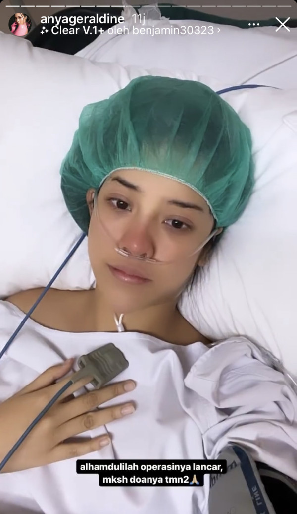 Anya Geraldine Sakit dan Jalani Operasi Gara-gara Inflamasi Usus