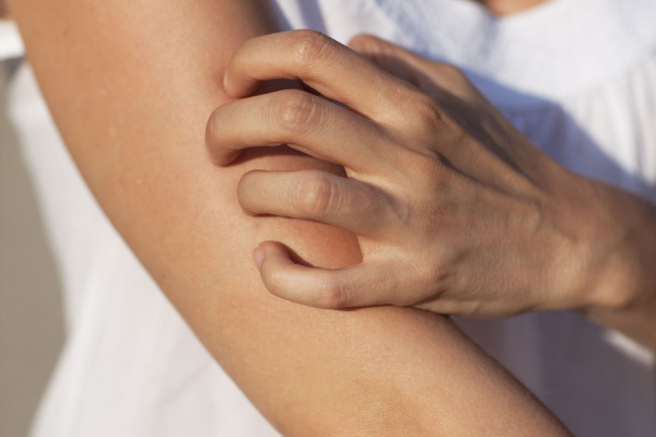 9 Gejala Diabetes yang Sering Tak Disadari, Salah Satunya Sering Lapar