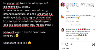Cita Citata Dituding Netizen Lakukan Operasi Plastik: Repot