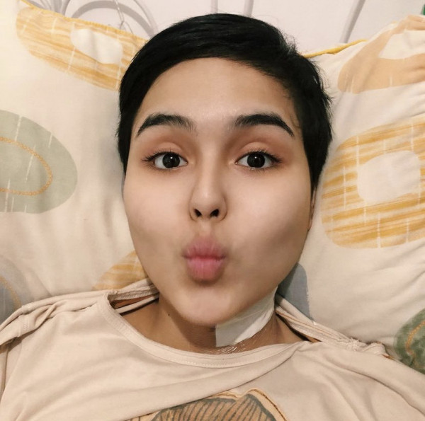 Tak Kenal Lelah, Ini 7 Momen Laura Anna Berjuang Sembuh dan Mendapat Keadilan