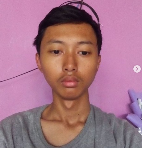 5 Potret Ghozali Everyday yang Jual Foto Selfie Rp13 Miliar, Nomor Terakhir Wajahnya Dianggap Unik