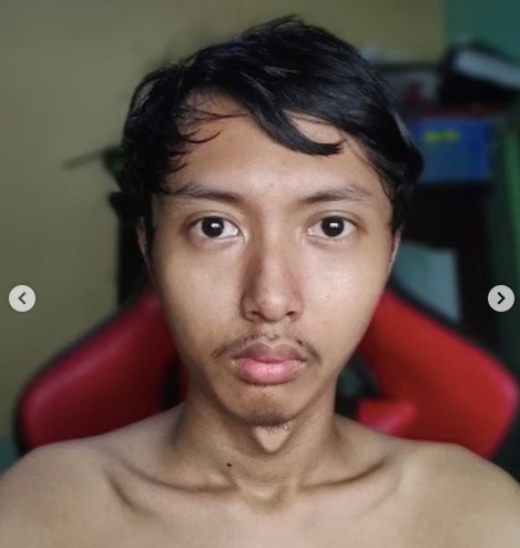 5 Potret Ghozali Everyday yang Jual Foto Selfie Rp13 Miliar, Nomor Terakhir Wajahnya Dianggap Unik