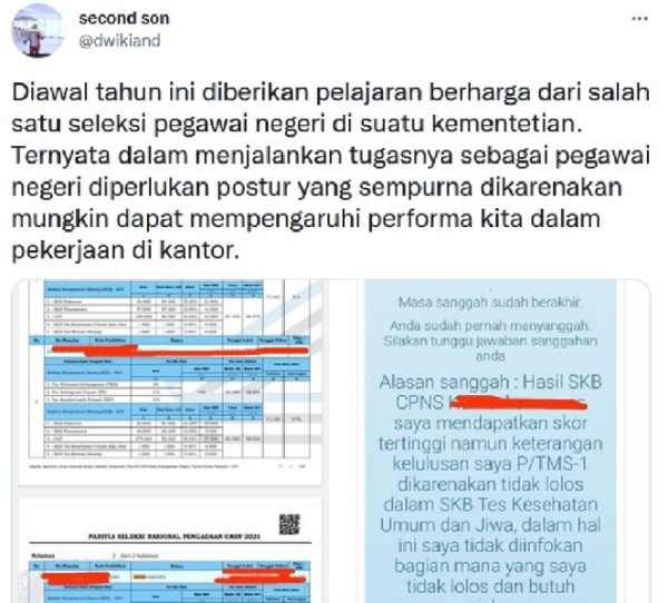 Ukuran Payudara Besar Pria Ini Gagal Jadi CPNS, Berikut Penjelasan BKN