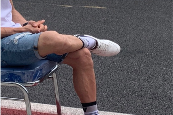 Penampakan Luka Jahitan di Lengan dan Paha Marc Marquez yang Bikin Penasaran