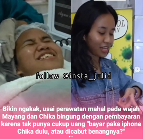 Mayang dan Chika Tak Mampu Bayar Perawatan Rp90 Juta, Dibuat Konten hingga Diduga Cuma Gimmick