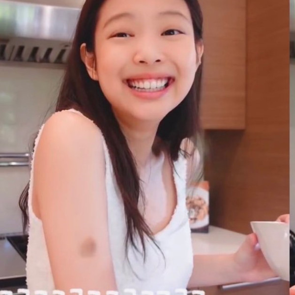 Memar di Tangan Jennie BLACKPINK Jadi Sorotan, Ternyata Ini Penyebabnya