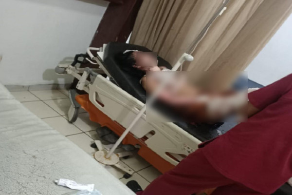 Penampakan Brigpol AN Oknum Anggota Polisi yang Bakar Kekasihnya dengan Bensin