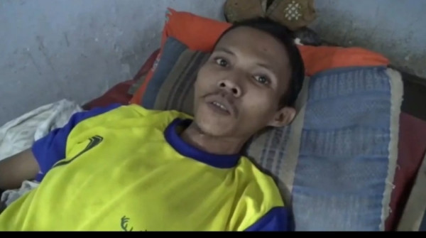 Aneh Tapi Nyata, Ada Gelas Kaca dalam Perut Pemuda Jember