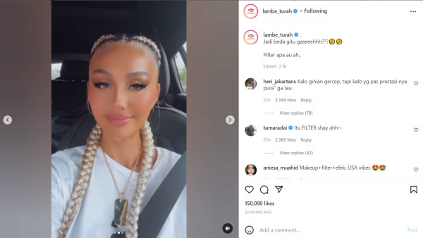 Wajah Agnez Mo Bikin Pangling, Netizen Curiga Hasil Operasi Plastik