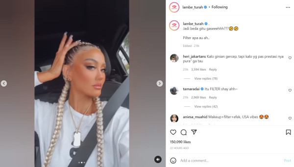 Wajah Agnez Mo Bikin Pangling, Netizen Curiga Hasil Operasi Plastik