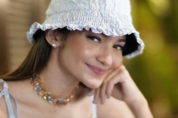 4 Artis Indonesia Ini Pernah Kena Autoimun, Nomor 3 Bikin Kaget!