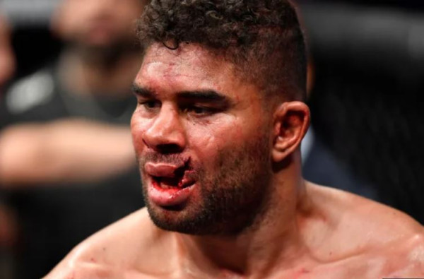 9 Cedera Terburuk Petarung UFC yang Mengerikan dalam Sejarah UFC