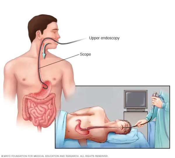 Biopsi Virtual Jadi Angin Surga Buat Pasien Transplantasi Jantung