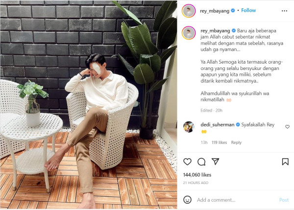 Rey Mbayang Unggah Foto Sebelah Mata Diperban, Singgung soal Nikmat yang Dicabut
