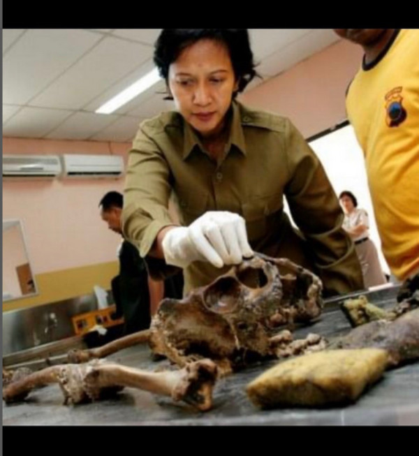 Profil Kombes Pol Sumy Hastry, Polwan Pertama Dokter Forensik Tim DVI Bom Kedubes Australia dan Hotel JW Marriot
