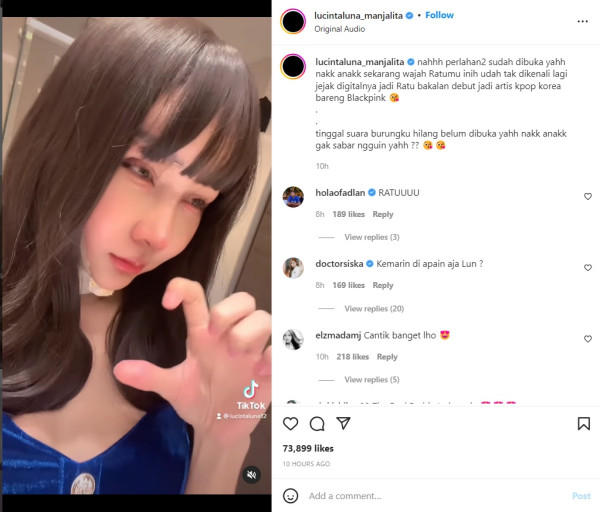 Lucinta Luna Ungkap Wajah Baru usai Operasi Plastik, Disebut Lebih Cantik Sebelumnya