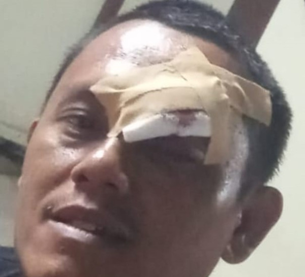 ASN di Karawang Diduga Terlibat Kasus Penculikan dan Penganiayaan