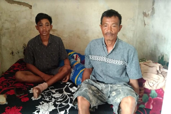 Kesaksian Nur Saguwanto Korban Tragedi Kanjuruhan, Kaki Patah Muka Melepuh dan Sesak Napas