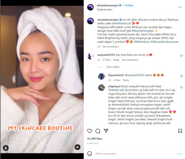 Amanda Manopo Bagikan Rutinitas Skincare, Cincin di Jari Manis Jadi Sorotan