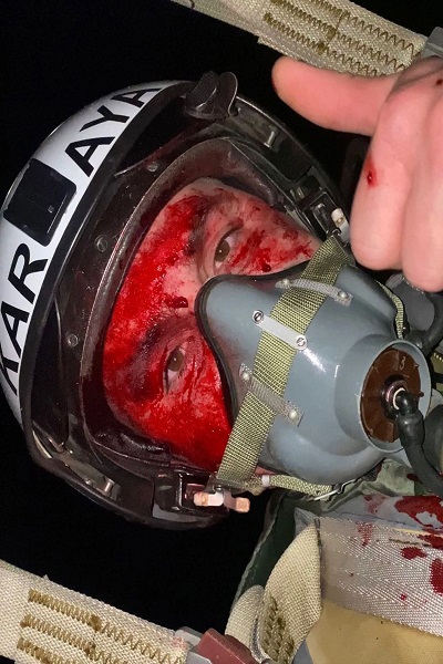 Jet Tempurnya Dihantam Drone Iran, Pilot Ukraina Selfie Wajah Penuh Darah