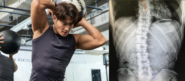 6 Artis Korea yang Pernah Kecelakaan Parah, Termasuk Lee Min-Ho
