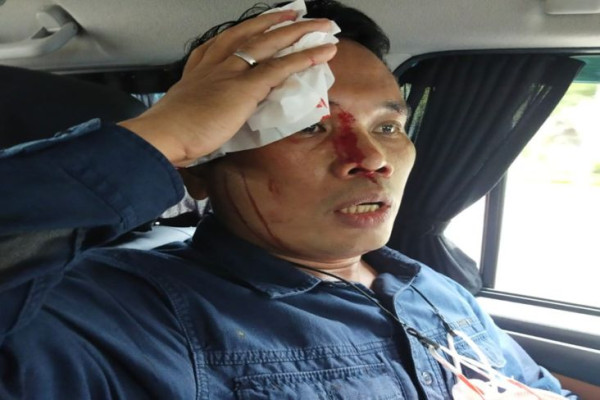 Profil AKBP Ferikson Tampubolon, Kapolres Pelabuhan Tanjung Priok yang Baru