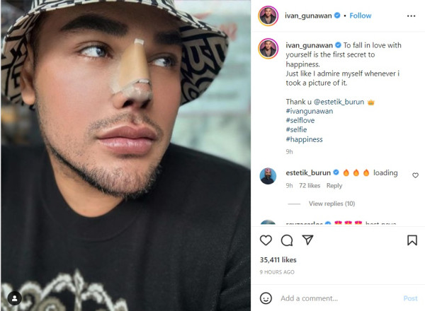 Hidung Ivan Gunawan Diperban, Netizen: Bagus yang Asli