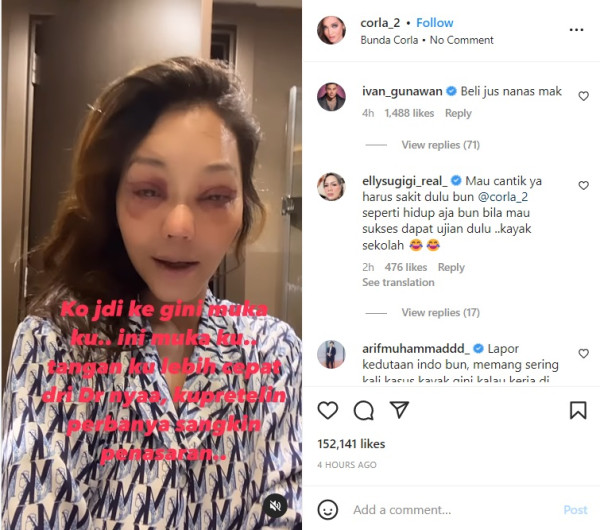 Bunda Corla Pamer Wajah Baru usai Operasi Plastik: Ini Mukaku?