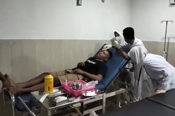 Diamuk Penghuni Kos, Pria Diduga Pencuri Tewas Bersimbah Darah