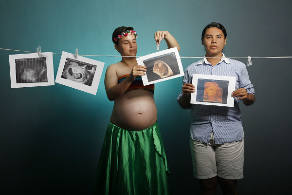 Pasangan Transgender yang Menggemparkan Dunia