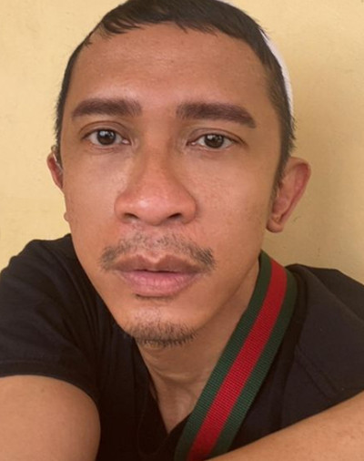 Aming Ditawari Tompi Operasi Hidung Gratis, Netizen: Gak Usah, Kayak Gitu Aja Bagus