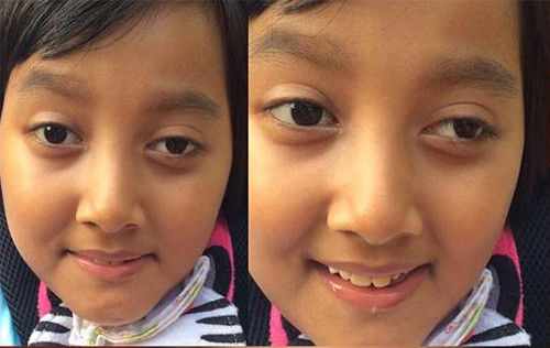 4 Anak Artis yang Meninggal Dunia di Usia Muda, Terbaru Putri Abdel Achrian