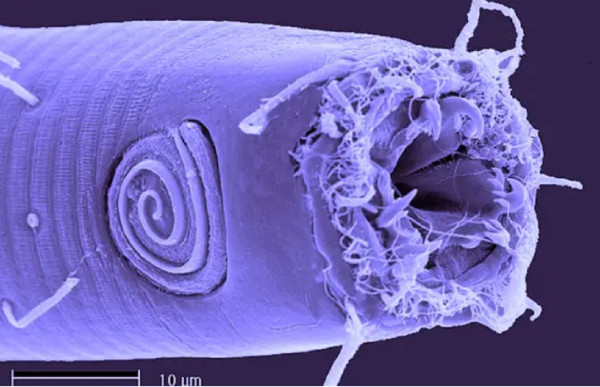 Mengenal Nematoda, Cacing Gelang Alien Parasit yang Hidup di Pantai Berpasir