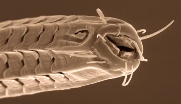 Mengenal Nematoda, Cacing Gelang Alien Parasit yang Hidup di Pantai Berpasir