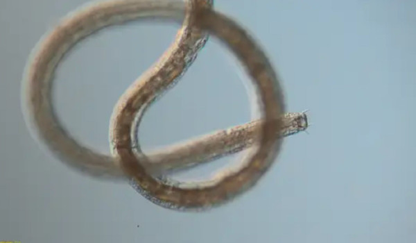 Mengenal Nematoda, Cacing Gelang Alien Parasit yang Hidup di Pantai Berpasir