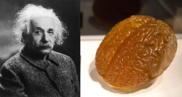 Kisah Tragis Dokter Pencuri Otak Albert Einstein Akhirnya Dibuat Jadi Film