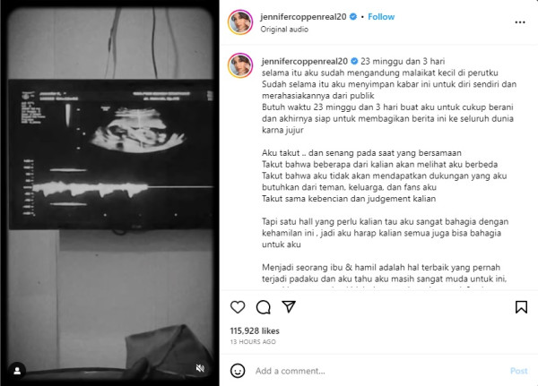 Jennifer Coppen Umumkan Kehamilan, Warganet: Biasa Kali ya Hamil Tanpa Ikatan Pernikahan?