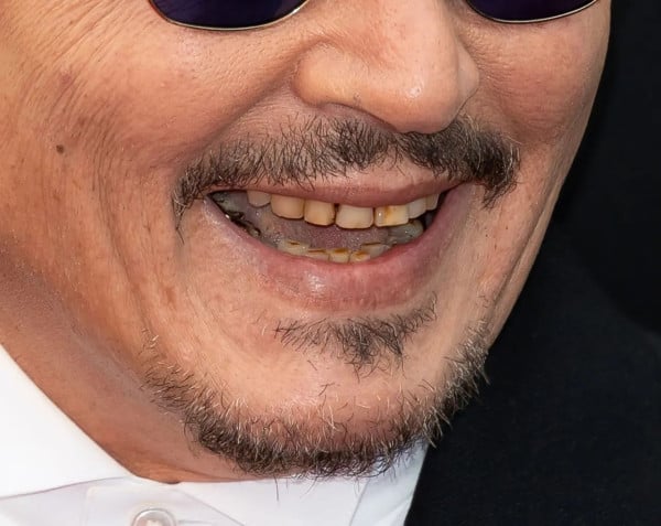 Penampilan Johnny Depp di Cannes Film Festival Jadi Sorotan, Giginya Diduga Busuk