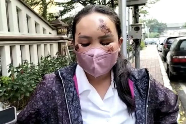 Pria yang Tabrak Pacar di Prapanca Raya Berkecepatan Tinggi