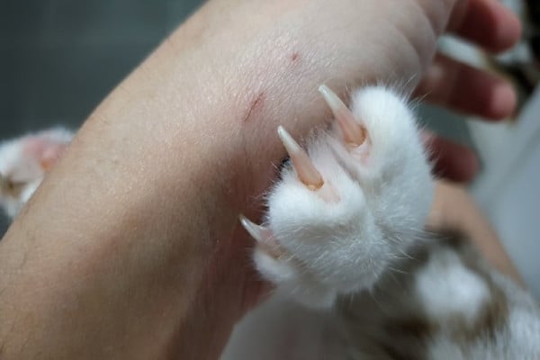 7 Bahaya Bulu Kucing yang Harus Diwaspadai, Nomor 5 Bisa Akibatkan Keguguran pada Ibu Hamil