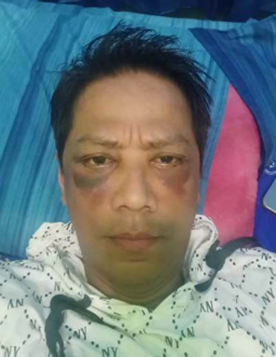 Wajah Doddy Sudrajat Pasca Operasi Kantung Mata Bikin Syok, Netizen: Kayak Abis Digebukin