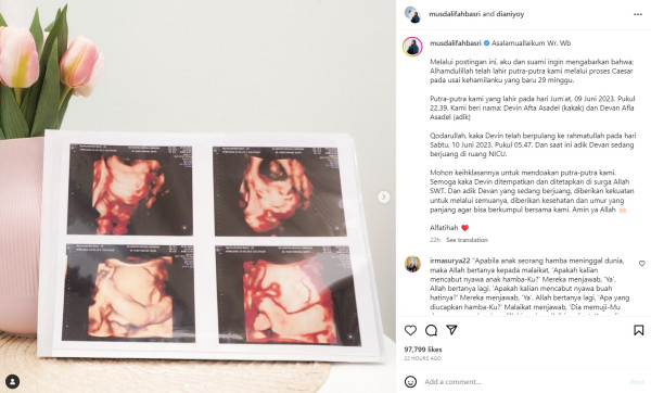 Komika Musdalifah Berduka, Salah Satu Anak Kembarnya Meninggal Dunia