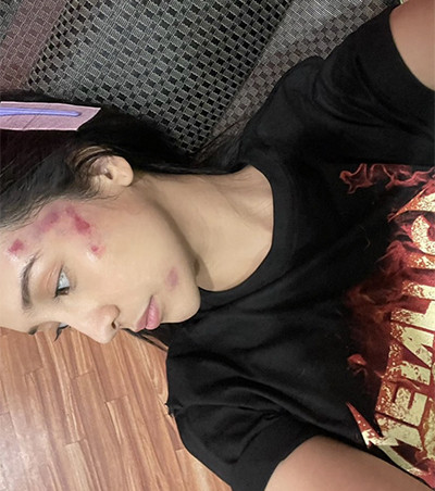 Waduh! Anya Geraldine Ketiban Pohon Durian, Wajahnya Lebam