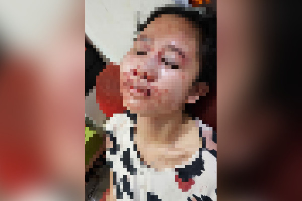 Ngeri! Suami Pelaku KDRT di Serpong Ancam Bantai Istri beserta Keluarga