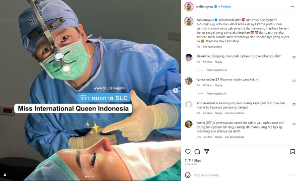 Hidung Millen Cyrus Nyaris Jebol Gegara Implan Tidak Simetris, Begini Kondisinya Sekarang