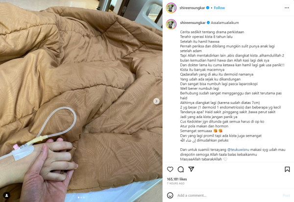 Shireen Sungkar Jalani Operasi Pengangkatan Kista, Kesakitan saat Menstruasi