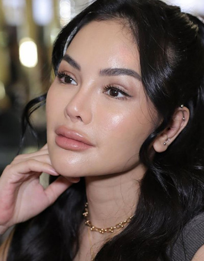 Nikita Mirzani Pamer Wajah Hasil Oplas di Korea, Netizen: Mukanya Berubah Drastis