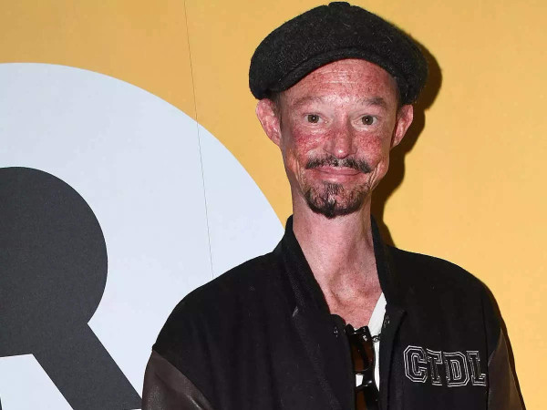 Aktor Game of Thrones Darren Kent Meninggal, Ini Riwayat Penyakitnya