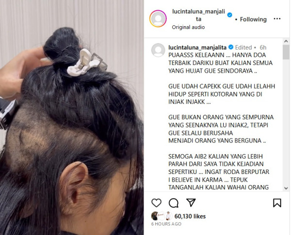 Lucinta Luna Cukur Botak Rambut Bagian Belakang, Kesal Di-bully Netizen