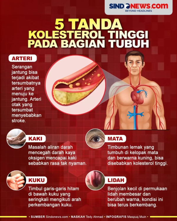 Cara Membuat Air Rebusan Serai untuk Menurunkan Kolesterol dalam 14 Hari